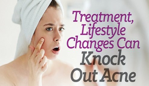 Treatments and Lifestyle Changes to Knock out Acne