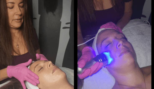Reveal Your Best Skin With Hydra-Dermabrasion 
